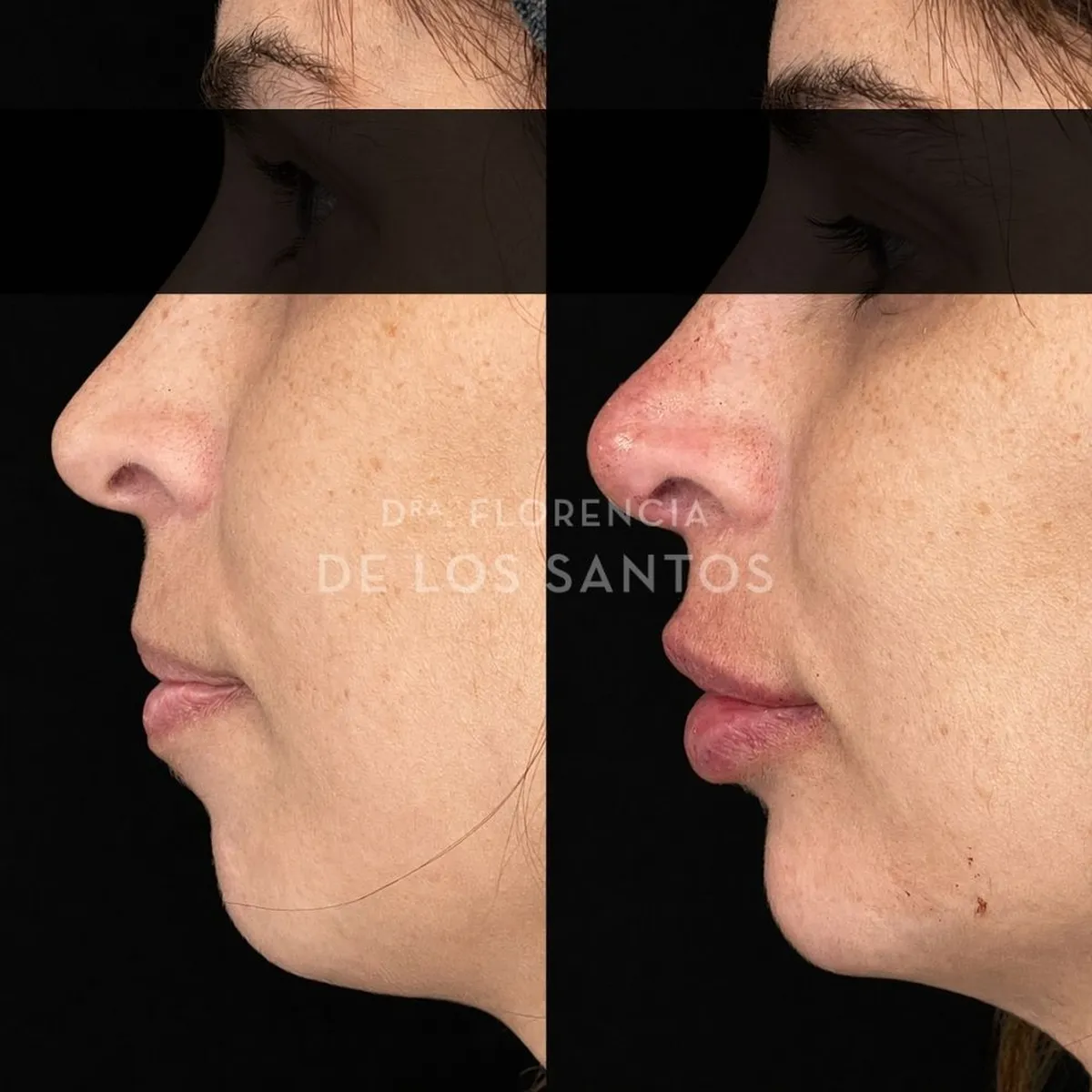 Armoozación Facial Dra Florencia de los Santos Medicliniq26