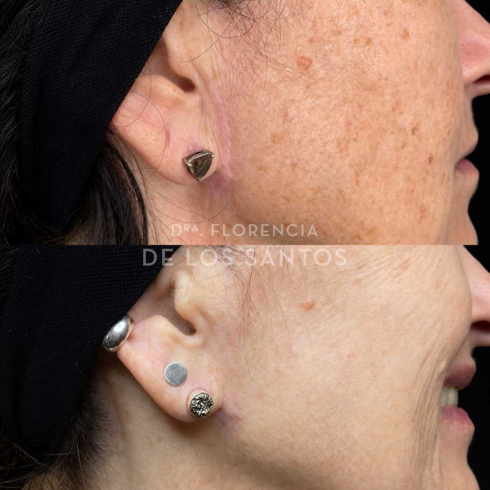 Cicatrices y lesiones de piel