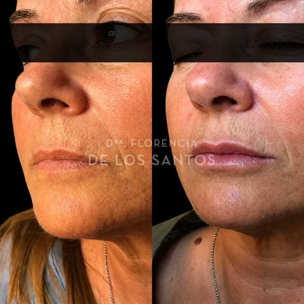Labios medicliniq montevideo