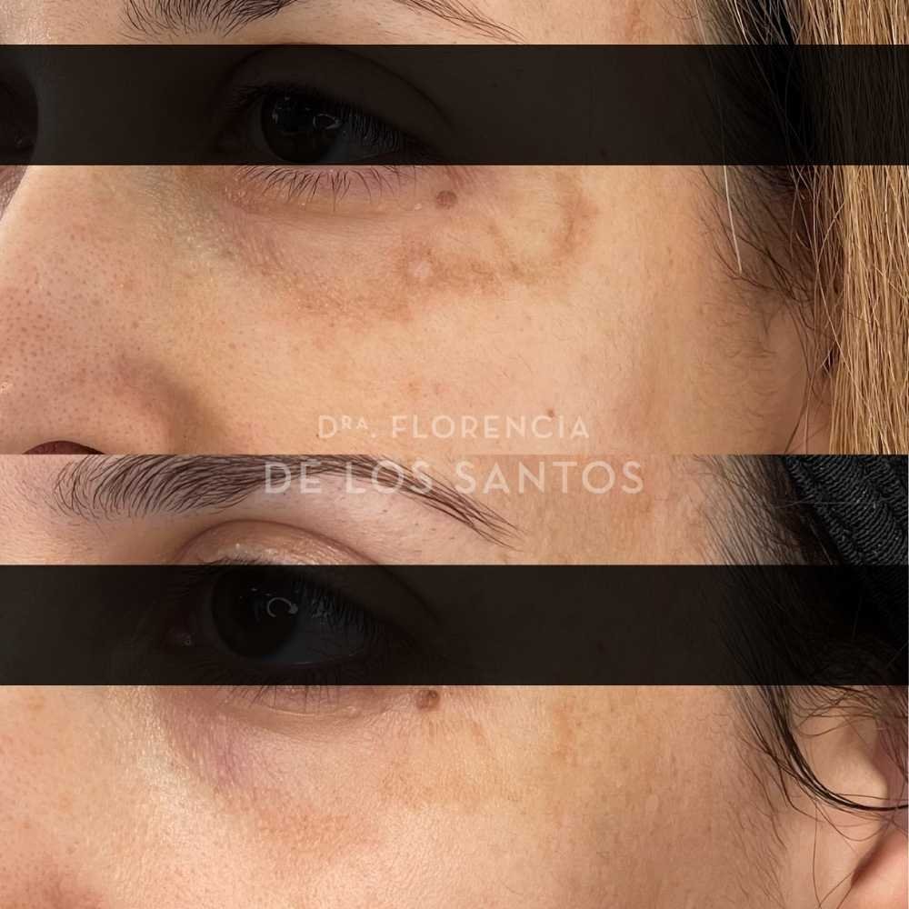 Manchas medicliniq montevideo