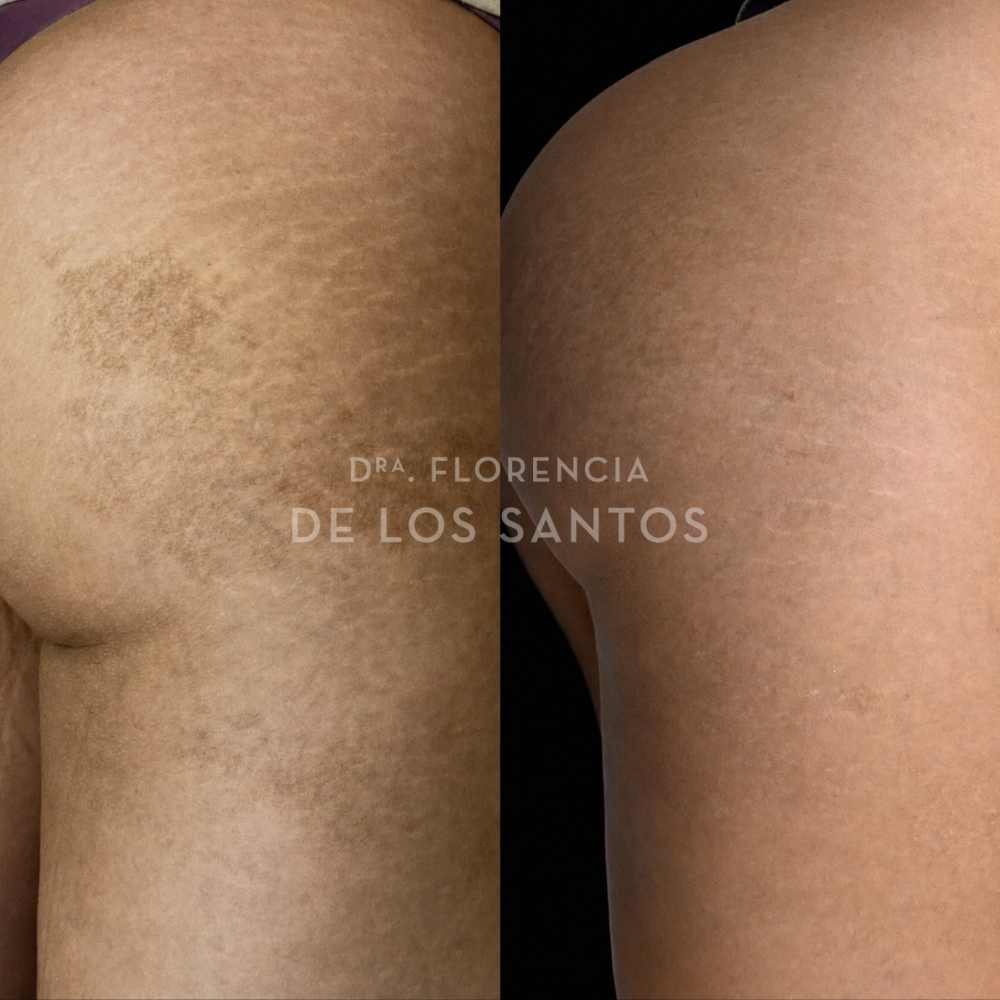 Manchas medicliniq montevideo